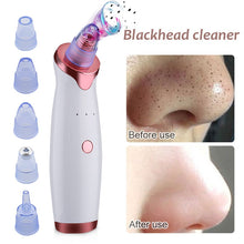 Load image into Gallery viewer, Electric Acne Remover Blackhead Vacuum
